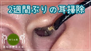 【耳かき】2週間ぶりの耳掃除【ear cleaning】 [upl. by Guarino]