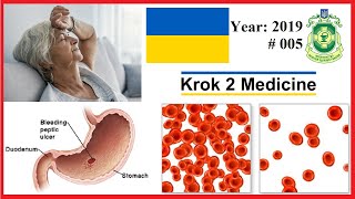 Krok 2 Medicine  Year 2019  005 Ministry of Public Health of Ukraine [upl. by Omero]