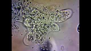 Amoeba amp Cytoplasmic Streaming [upl. by Kiyohara]