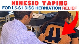 Kinesio Taping for L5S1 Herniated Disc L5S1 Disc Herniation  Dr Marc Dupuis Chiropractor [upl. by Wilfrid]