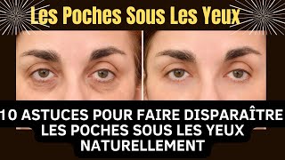 Comment faire disparaître les poches sous les yeux naturellement et rapidement [upl. by Tully]