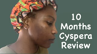 Cyspera Before And After 10 Months Review Answering Questions [upl. by Kcirrek724]