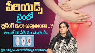 పీరియడ్స్ లో తక్కువ రక్తస్రావం  Causes Of Light Bleeding In Periods  Scanty Bleeding  Dhatri TV [upl. by Idola391]