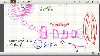 Regeneracion nerviosa snp Parte 2 Neuroapraxia Axonotmesis Neurotmesis Histologia [upl. by Loredana]