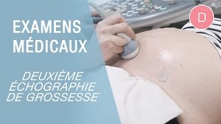 La 2e échographie de grossesse  Examens grossesse [upl. by Meridith905]