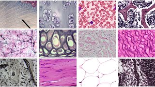 Practice Identifying Connective Tissue Complete [upl. by Llecrad]