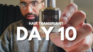 Day 10 Hair Transplant Journey  Some Normality 😌 [upl. by Lamag240]