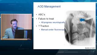 Occipital Cervical Fusion Indications and Techniques [upl. by Itsa]