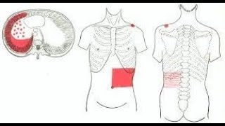 Why Pleurisy pain  Pleuritis pain is referred to the anterior abdominal wall [upl. by Nalepka]