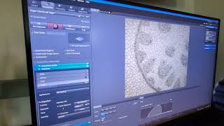 Multichannel overlay of brightfield and single channel fluorescence [upl. by Enirhtac]