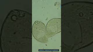 Balantidium Coli Microscopic Examination trending shortsviral shortvideo shorts [upl. by Atnahs]