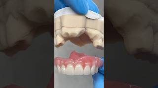 Fitting in the missing Anteriors ​⁠EnvisiontecMain envisiontec lsk121shorts dentist [upl. by Feinstein]