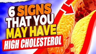 High Cholesterol Alert 6 Symptoms You Shouldnt Ignore [upl. by Rodrick]