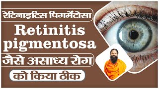 रेटिनाइटिस पिगमेंटोसा Retinitis pigmentosa जैसे असाध्य रोग को किया ठीक  Swami Ramdev [upl. by Adli]