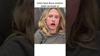 Twins Get Their Wisdom Teeth Removed [upl. by Head]