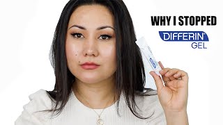 WHY I STOPPED USING DIFFERIN GEL  ADAPALENE GEL 01 ACNE TREATMENT  Zulayla [upl. by Ailsa]