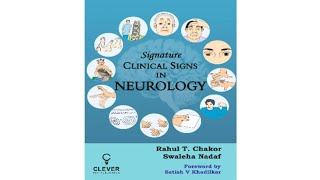 Signature Signs in Neurology Chapter 63 video 1 pronator catch [upl. by Margot858]