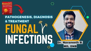 FUNGAL INFECTIONS  Pathogenesis  Diagnosis  Treatment  Harrison [upl. by Elimaj]