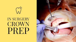 In the surgery tooth crown preparation [upl. by Berty]