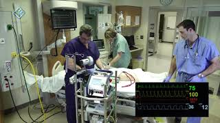 VA ECMO Arterial Air Emergency Cardiohelp  Innovative ECMO Concepts [upl. by Rehpotsirh]