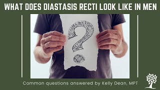 What Diastasis Recti Looks Like in Men [upl. by Ajiak]