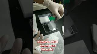 western blot membrane transfer [upl. by Gerita188]