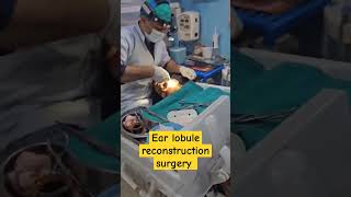 Ear lobule reconstruction surgery [upl. by Paige697]