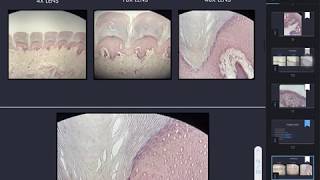 Keratinized stratified nonkeratinized stratified and transitional epithelium [upl. by Einahets]