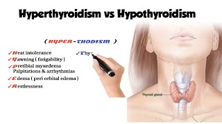 hyperthyroidism vs hypothyroidism [upl. by Camroc]