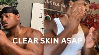 How To Get Clear Skin For Guys [upl. by Marcelline527]