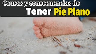 Causas y consecuencias de tener Pie plano [upl. by Anniram]