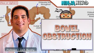 Bowel Obstruction  Clinical Medicine [upl. by Reinhart]