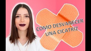 ¿Cómo desvanecer una cicatriz Cicatricure funciona  Story Time  Lylocyv [upl. by Ennovaj]