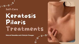 Spavelous Talks Keratosis Pilaris Treatments SelfCare for Chicken Skin [upl. by Ahsital]