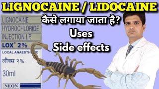 Lidocain injection  Lignocain injection  Lox 2 injection  xylocaine injection uses side effects [upl. by Spring]