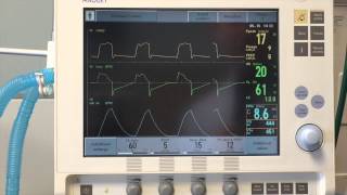 Introduction to Mechanical Ventilation [upl. by Buckels526]