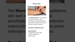 Mantoux test procedure [upl. by Holt]