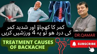 Treatment causes of backache  Dr Qamar [upl. by Latsyk878]