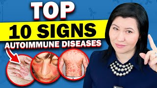 Top 10 Signs of Autoimmune Diseases  A Rheumatologists Guide [upl. by Delly]