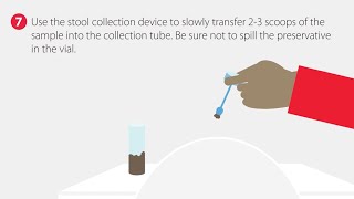 How to Collect a Fecal Sample  StepbyStep Guide [upl. by Schroer]