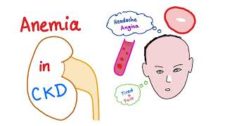 Anemia in Chronic Kidney Disease [upl. by Singband]