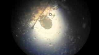 Scabies Mite Video HD [upl. by Etnoek731]