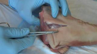 Suture  Basic Technique 1 [upl. by Nayar645]