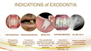 indication and contraindication of exodontia [upl. by Yona]