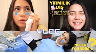 YİRMİLİK DİŞ ÇEKİMİ AMELİYATIM NASIL OLDU🦷NELER YAŞADIM😢İYİLEŞME SÜRECİM yirmilikdiş gömülü [upl. by Ynamad]