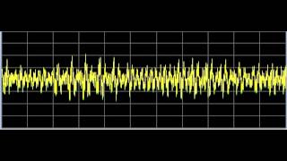 Diabetes 1  Rife Frequencies [upl. by Dranek]