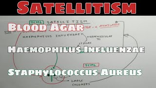 Satellitism  Identification of Haemophilus Influenzae  Microbiology  TCML [upl. by Danie662]