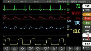 心電図モニター シュミレーション 安定 [upl. by Aisatna]