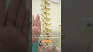 What is Ankylosing Spondylitis [upl. by Latrice]