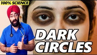 Permanently Cure DARK CIRCLES  आँखों के काले घेरे  Science  Home Remedy in HIndi  DrEducation [upl. by Aisauqal]